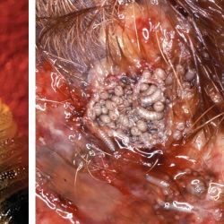 Close up of head-end of screwworm fly larva (maggot) and dense infestation of screwworm fly larvae in open wound 