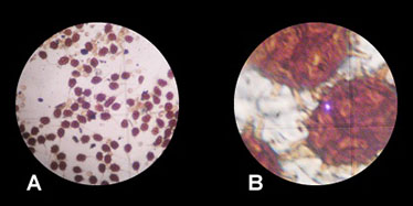 Image of fungal spores viewed through a microscope