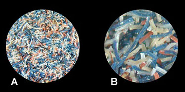 Image of fibres viewed through a microscope